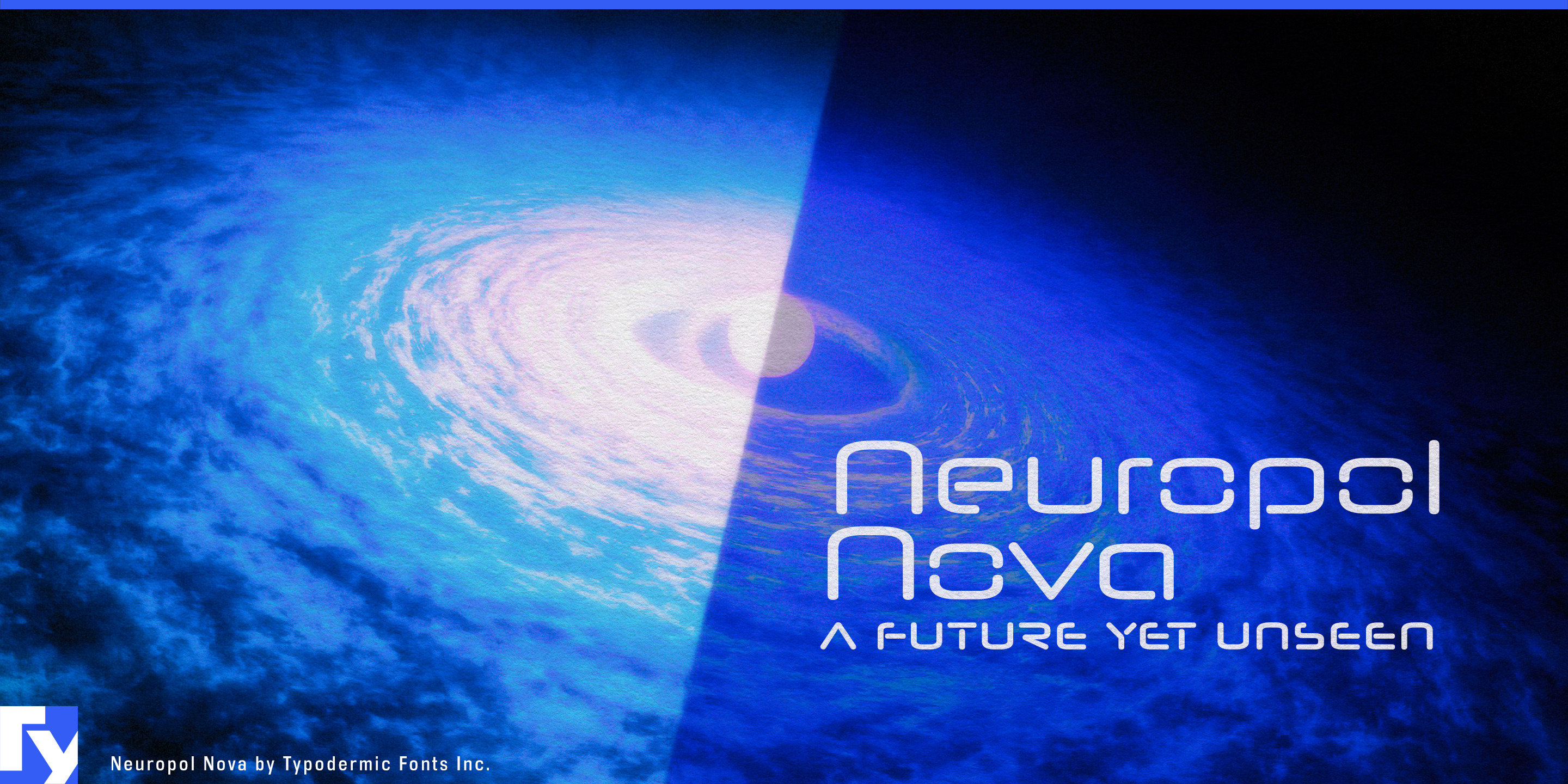 Neuropol Nova specimen 1